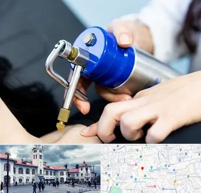 کرایوتراپی در میدان شهرداری رشت