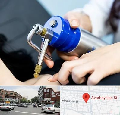 کرایوتراپی در خیابان آذربایجان