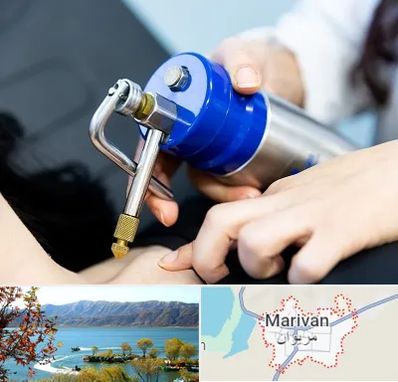 کرایوتراپی در مریوان