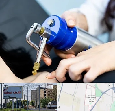 کرایوتراپی در فاز یک اندیشه