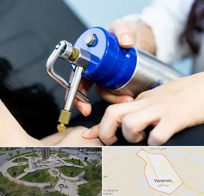 کرایوتراپی در ورامین