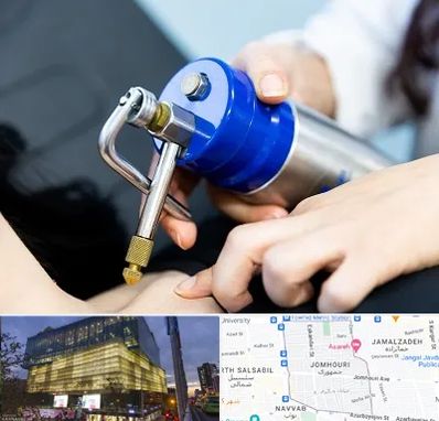 کرایوتراپی در جمهوری 