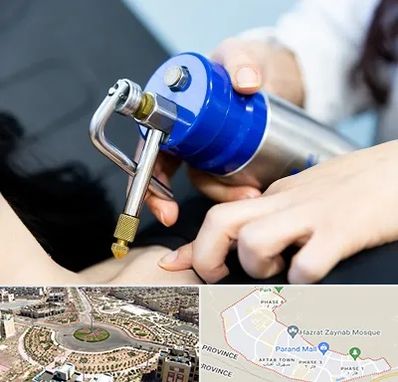 کرایوتراپی در پرند