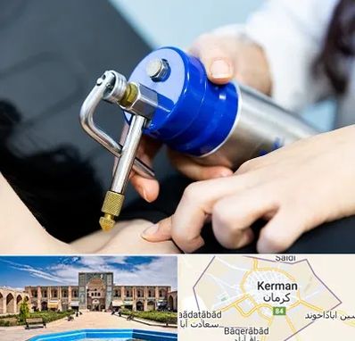 کرایوتراپی در کرمان