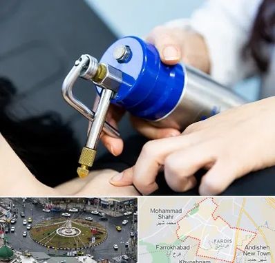 کرایوتراپی در فردیس کرج 