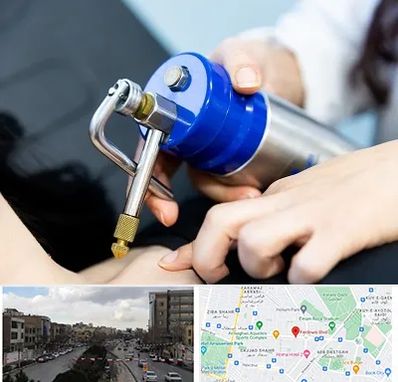 کرایوتراپی در بلوار فردوسی مشهد 