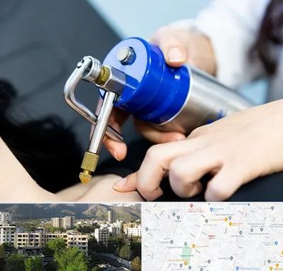 کرایوتراپی در دیباجی 