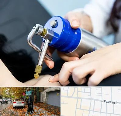 کرایوتراپی در خیابان فلسطین