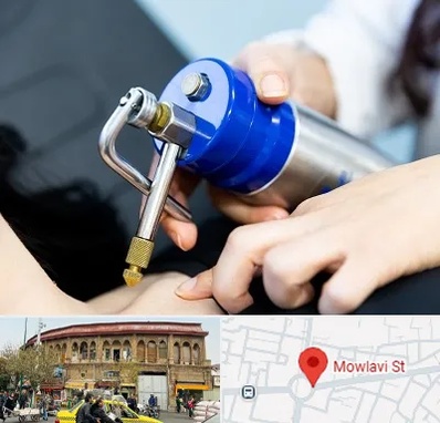 کرایوتراپی در مولوی