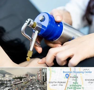 کرایوتراپی در پونک 