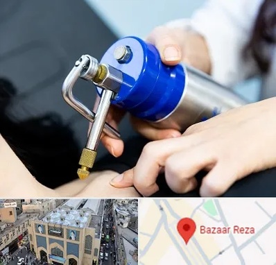 کرایوتراپی در بازار رضا مشهد