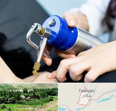 کرایوتراپی در طالقان