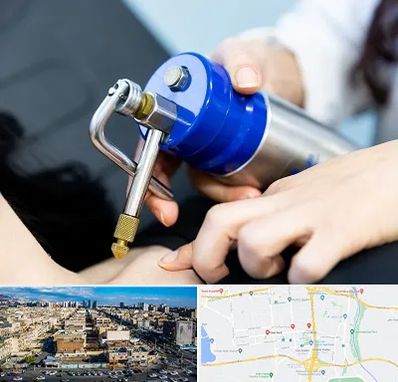 کرایوتراپی در شهرک راه آهن