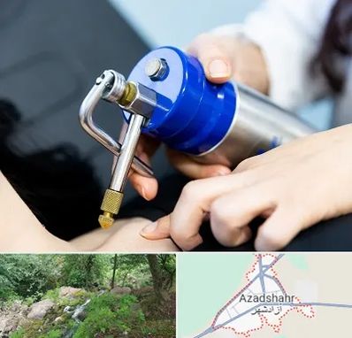 کرایوتراپی در آزادشهر