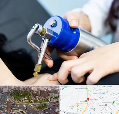 کرایوتراپی در سبلان 