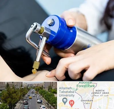 کرایوتراپی در شهران 