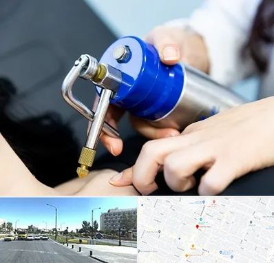 کرایوتراپی در بلوار کلاهدوز مشهد 