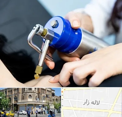 کرایوتراپی در لاله زار