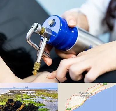 کرایوتراپی در بندرلنگه