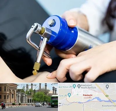 کرایوتراپی در پاکدشت