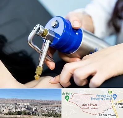 کرایوتراپی در شهرک گلستان شیراز