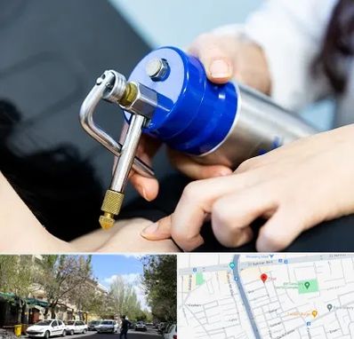 کرایوتراپی در کوی فیروز تبریز