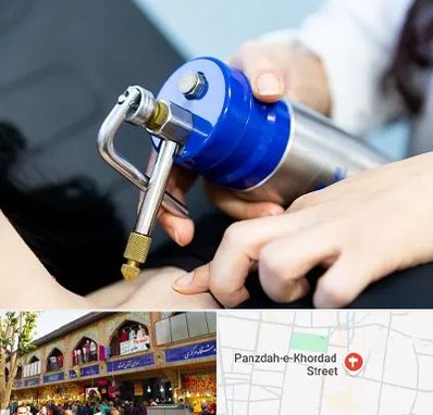 کرایوتراپی در 15 خرداد