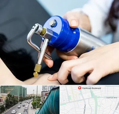 کرایوتراپی در بلوار فرحزادی