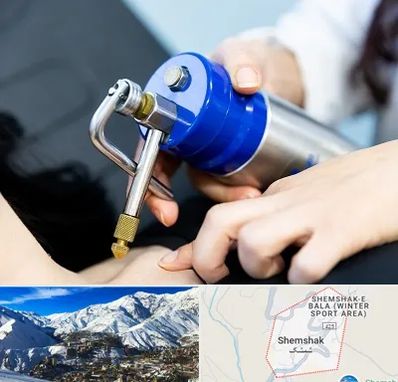 کرایوتراپی در شمشک