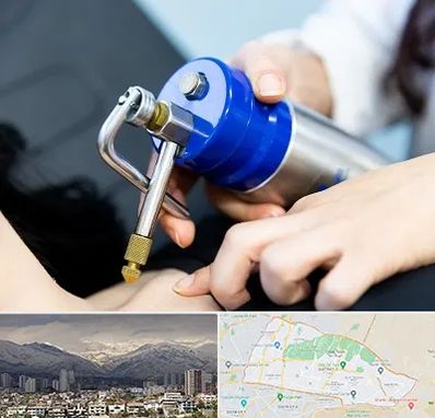 کرایوتراپی در منطقه 4 تهران 