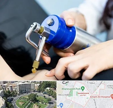 کرایوتراپی در جهانشهر کرج 