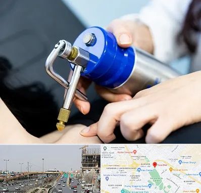 کرایوتراپی در بلوار توس مشهد 