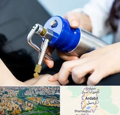 کرایوتراپی در اردبیل