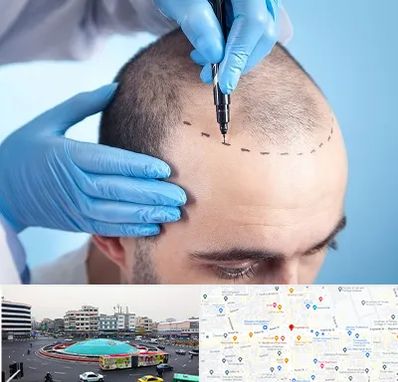 دکتر کاشت مو در میدان انقلاب 