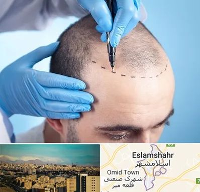 دکتر کاشت مو در اسلامشهر