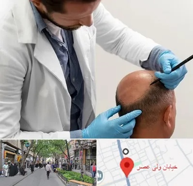 کاشت مو به روش تکثیری در ولیعصر شهریار