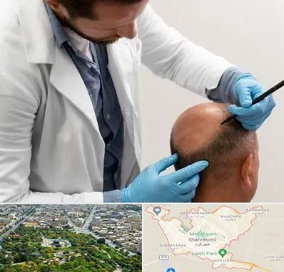 کاشت مو به روش تکثیری در شهرکرد