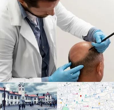 کاشت مو به روش تکثیری در میدان شهرداری رشت