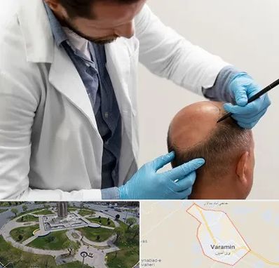 کاشت مو به روش تکثیری در ورامین