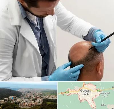 کاشت مو به روش تکثیری در گرگان
