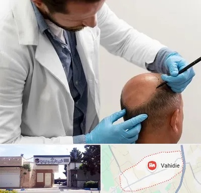 کاشت مو به روش تکثیری در وحیدیه شهریار