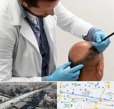 کاشت مو به روش تکثیری در فرجام