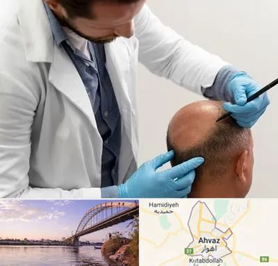 کاشت مو به روش تکثیری در اهواز