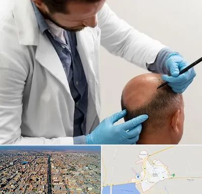 کاشت مو به روش تکثیری در بندر ماهشهر