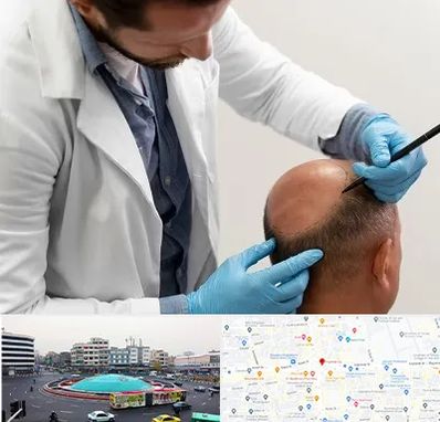 کاشت مو به روش تکثیری در میدان انقلاب 