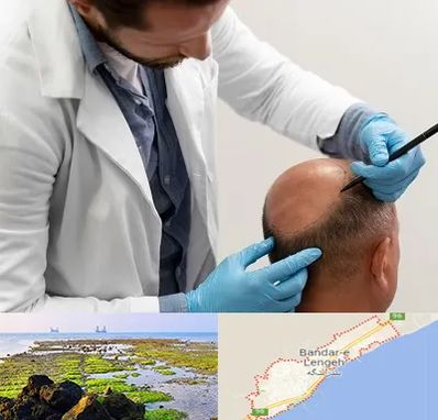 کاشت مو به روش تکثیری در بندرلنگه