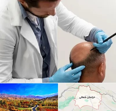 کاشت مو به روش تکثیری در خراسان شمالی