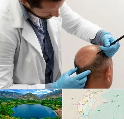 کاشت مو به روش تکثیری در رودبار