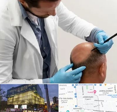 کاشت مو به روش تکثیری در جمهوری 