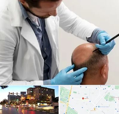 کاشت مو به روش تکثیری در بلوار سجاد مشهد 